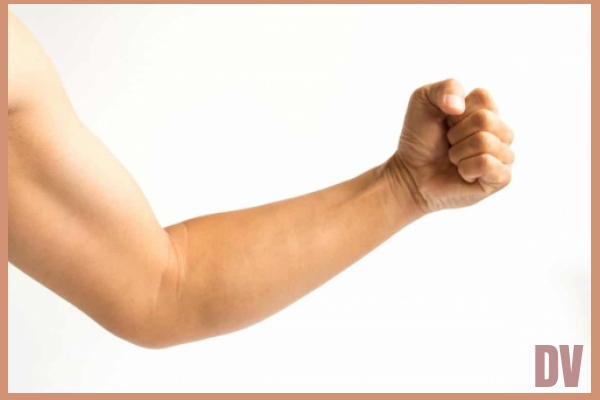Arm